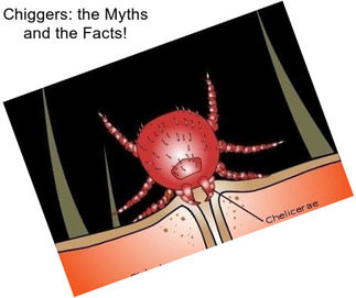 Chiggers: the Myths and the Facts!