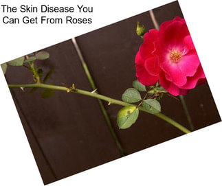 The Skin Disease You Can Get From Roses