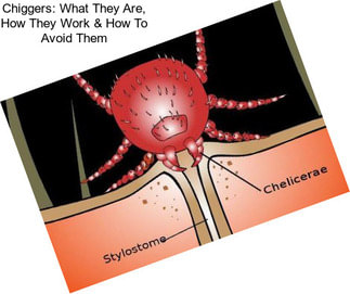 Chiggers: What They Are, How They Work & How To Avoid Them